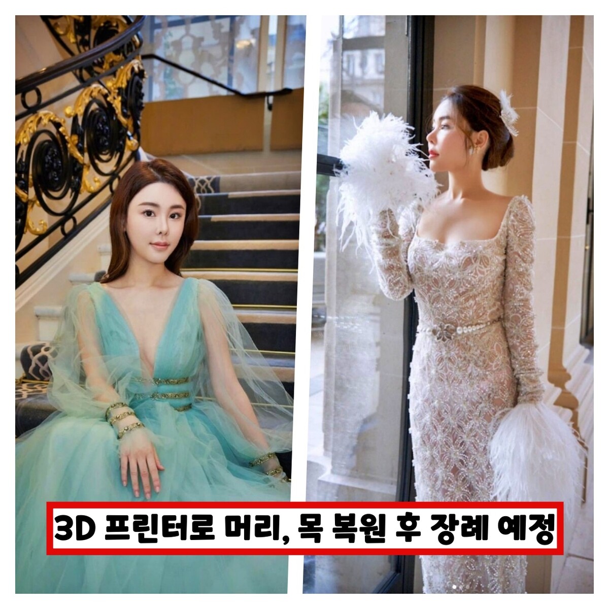 홍콩 모델 애비초이, 토막살인 때문에 유실된 신체 부위 3D 프린터로... 애비초이, 토막살인 때문에 유실된 신체 부위 3D 프린터로 만들어... 