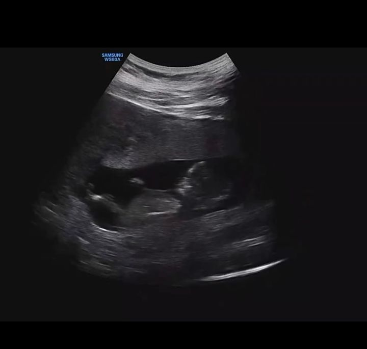 나윤권이 공개한 태아 초음파 사진. (사진=나윤권 인스타그램 캡처) 2024.06.25. *재판매 및 DB 금지 / 사진 = 뉴시스