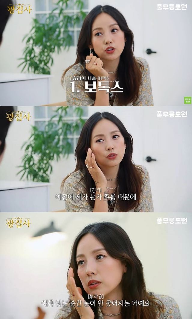 이효리, 보톡스 부작용 공개 "눈이 안 웃어지더라" / 사진 = 뉴시스