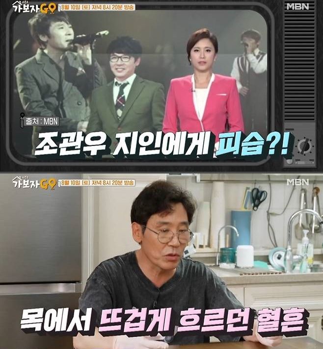 12년 전 조관우 피습 사건 "죽고 싶다 했더니.." 소주병으로 목 찌른 사람은... / 사진 = 뉴시스