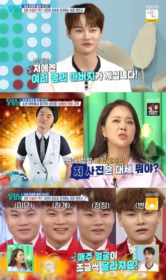 트로트가수 박서진 성형 고백..."다들 모르는데 풀튜닝한 것" / 사진 = 뉴시스