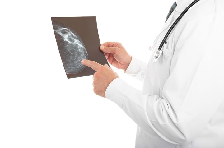 유방암은 조기발견이 중요하다. (사진=JW중외제약 홈페이지) 2024.12.15. *재판매 및 DB 금지 / 사진 = 뉴시스