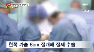 유방암 진단에 가슴 절제했는데…뒤늦게 