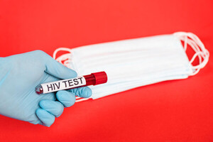 ȥ  HIV ˻ ǹȭ ϴ ε