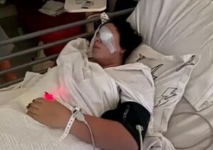 귀가하던 12세 소녀, 갑자기 날아든 ○○에 실명 위기